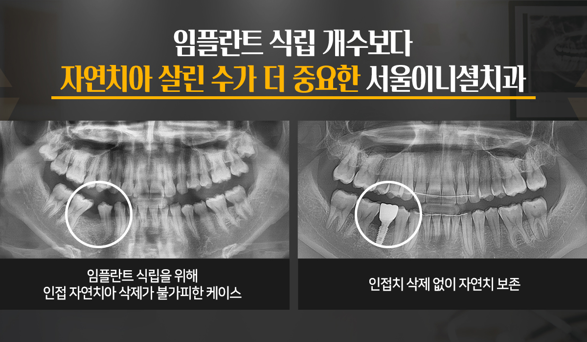 슬라이드5